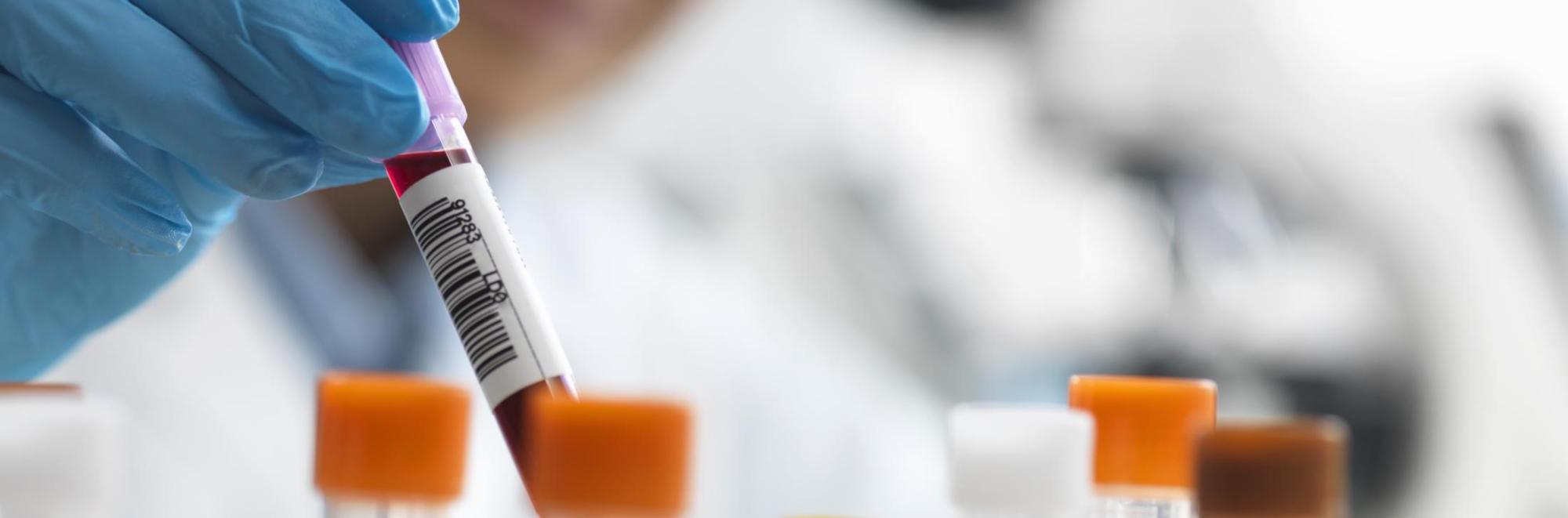 Person holding test tubes